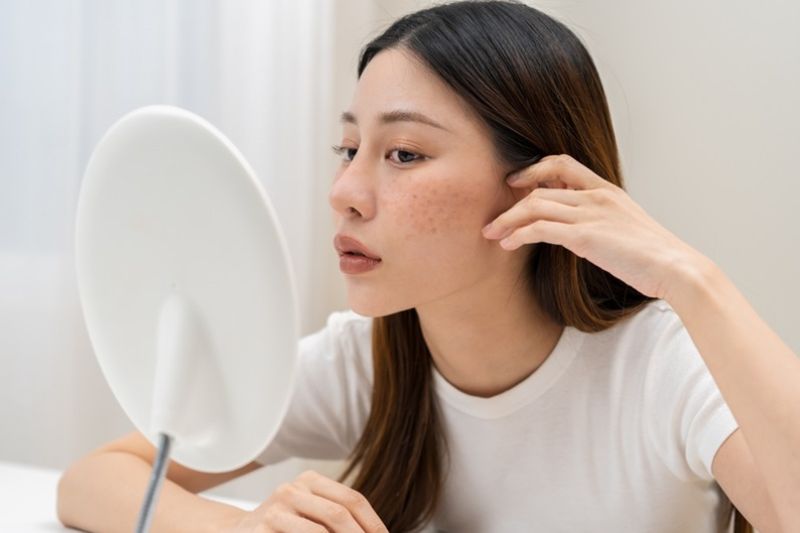 phụ nữ 40 tuổi dễ bị nám da