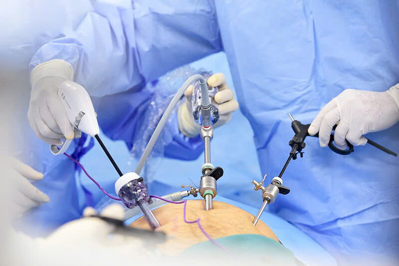 phẫu thuật nội soi cắt bỏ tuyến tiền liệt