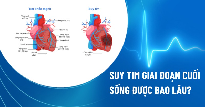suy tim giai đoạn cuối sống được bao lâu