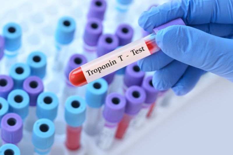 xét nghiệm troponin tim