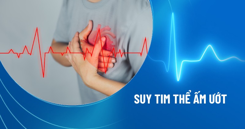 suy tim thể ấm ướt