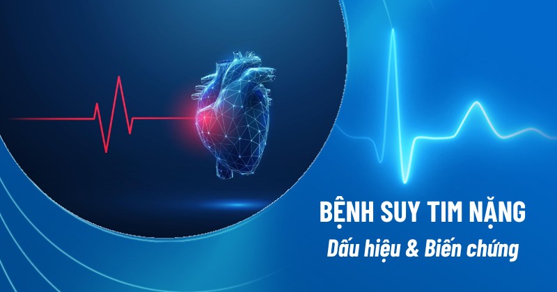bệnh suy tim nặng