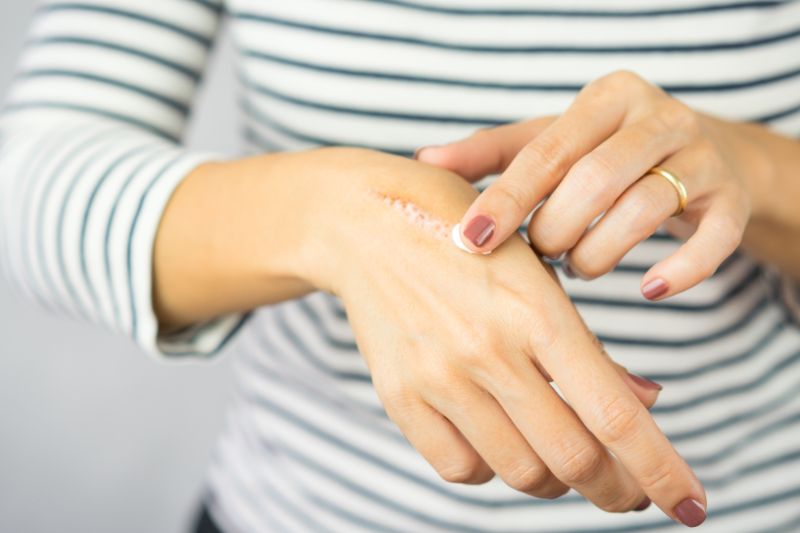 lấy lượng gel đầy đủ bôi lên da