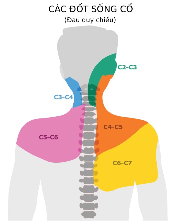 Các đốt sống cổ