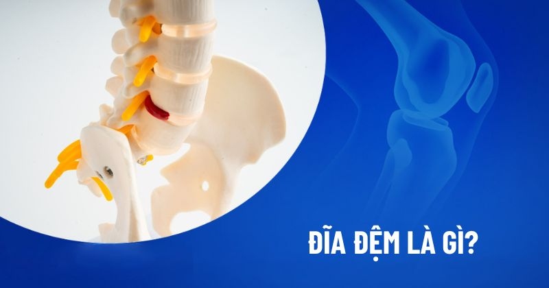 Đĩa đệm