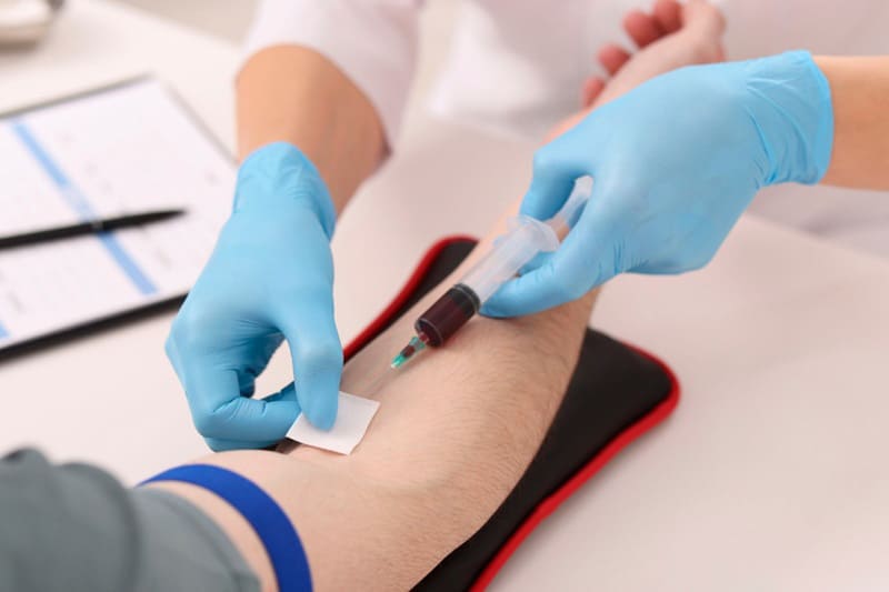 xét nghiệm thường diễn ra trong 5 phút
