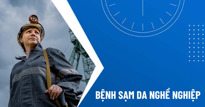 bệnh sạm da nghề nghiệp