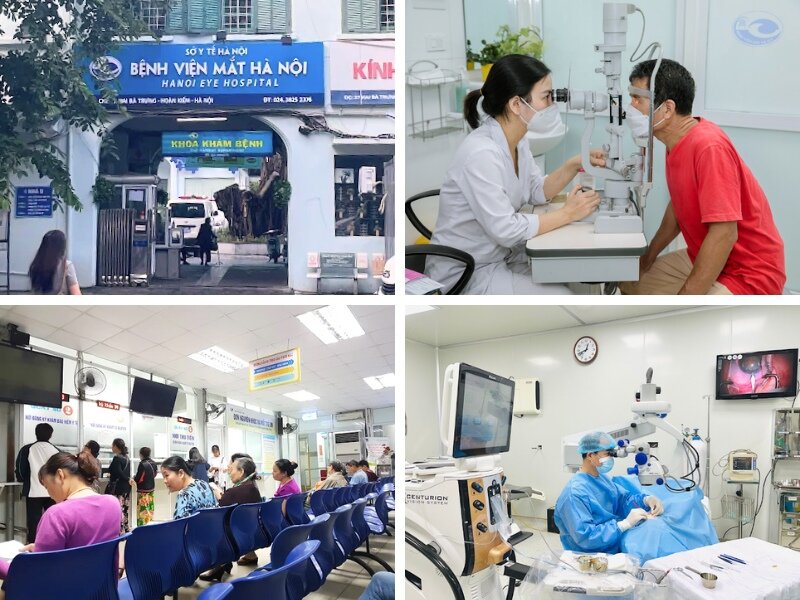 bệnh viện mắt hà nội