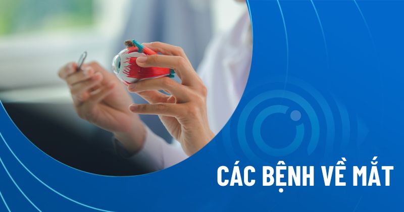 Các bệnh về mắt
