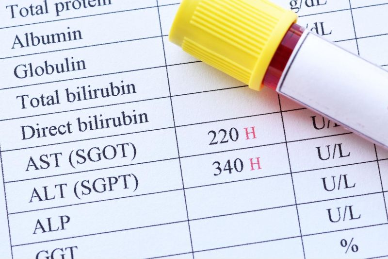các loại xét nghiệm viêm gan