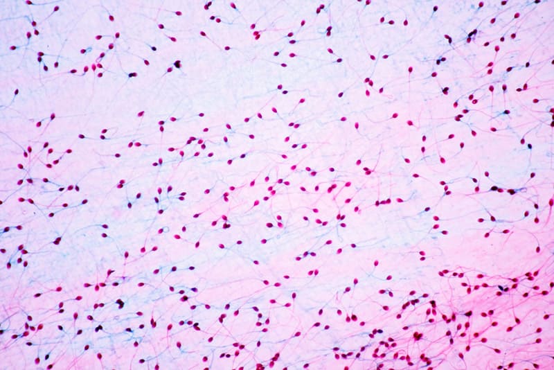 để đánh giá số lượng và chất lượng tinh trùng