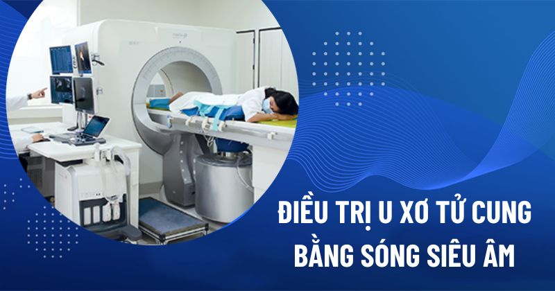 Điều trị u xơ tử cung bằng sóng siêu âm