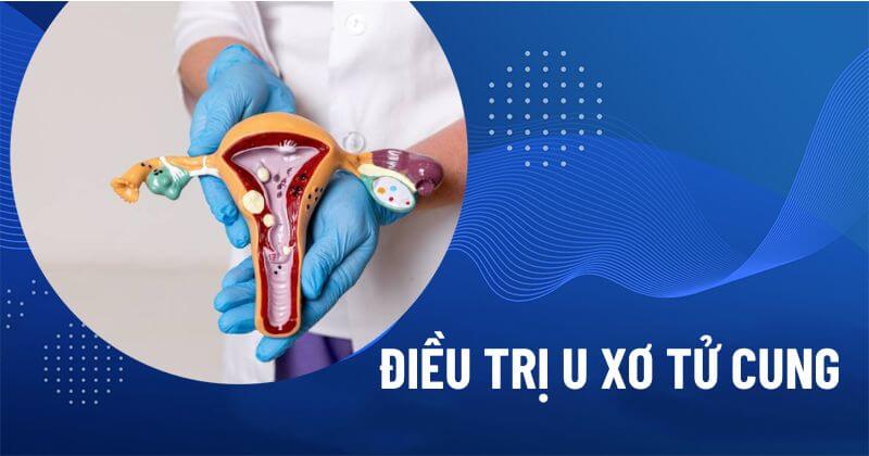 Điều trị u xơ tử cung
