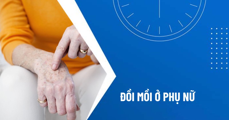 đồi mồi ở phụ nữ
