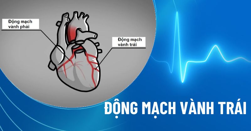 Động mạch vành trái