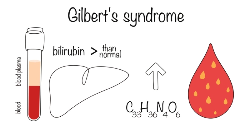 ngứa da do tích tụ muối mật và bilirubin