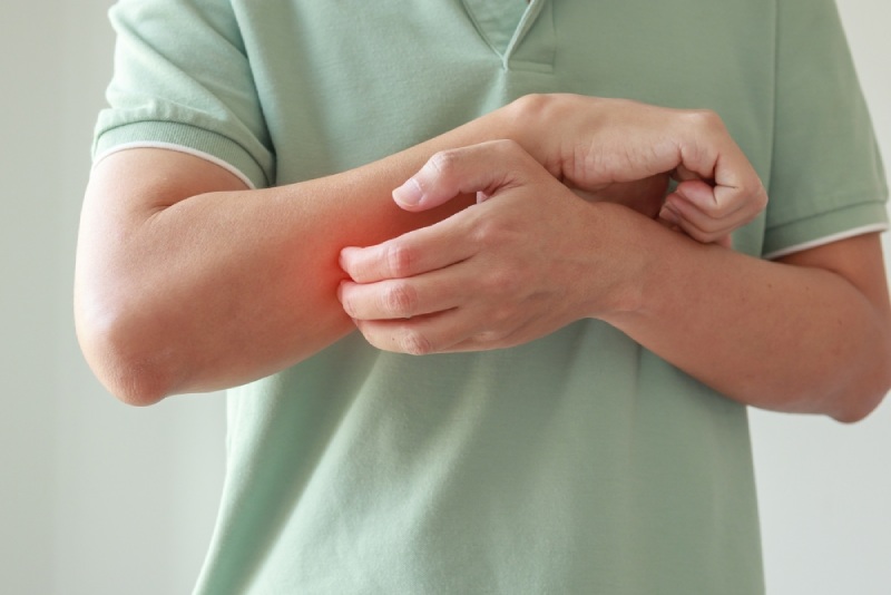 ngứa do viêm gan b