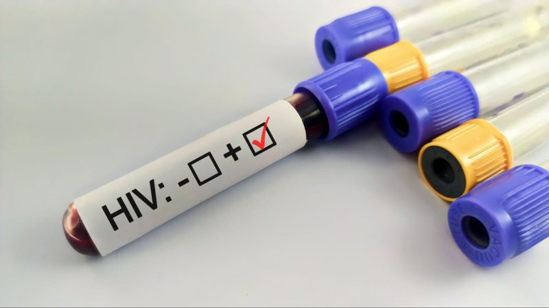 Nhiễm HIV là một trong những nguyên nhân có thể góp phần gây ra tình trạng mãn kinh sớm