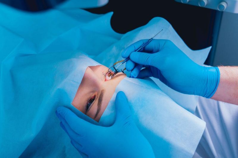 Phẫu thuật Lasik, PRK, SMILE Pro chữa loạn thị dưới 5 độ