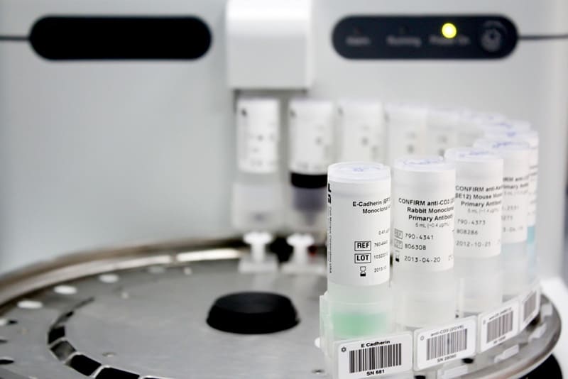 quy trình sản xuất gồm nhiều giai đoạn khắt khe