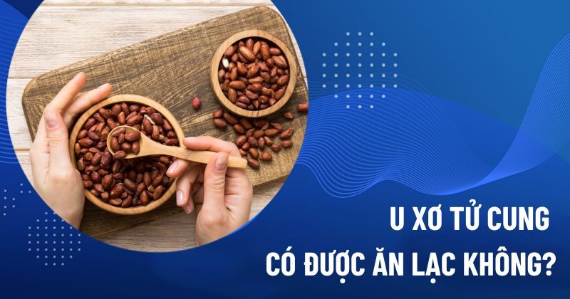 U xơ tử cung có được ăn lạc không?