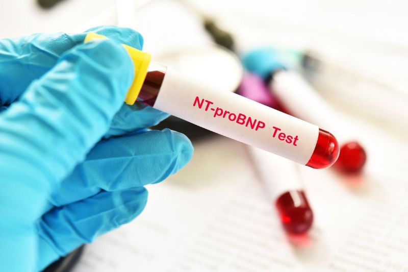 xét nghiệm chỉ dấu bnp nt-probnp chẩn đoán suy tim toàn bộ