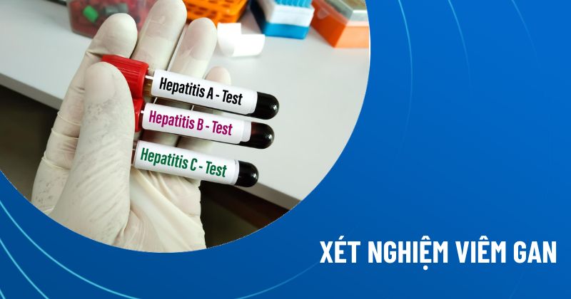 xét nghiệm viêm gan
