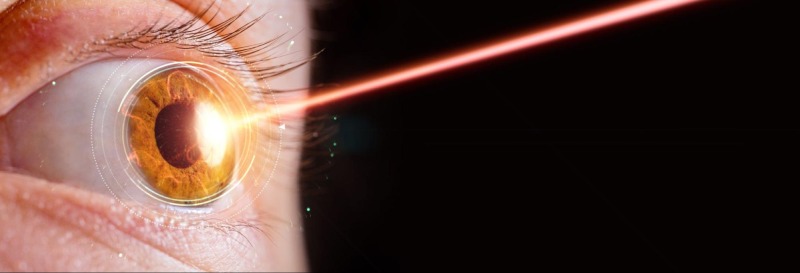 cơ chế phẫu thuật lão thị presbyond tương tự phẫu thuật lasik