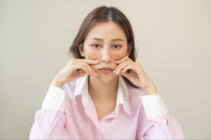 dầu mù u hỗ trợ làm mờ nám