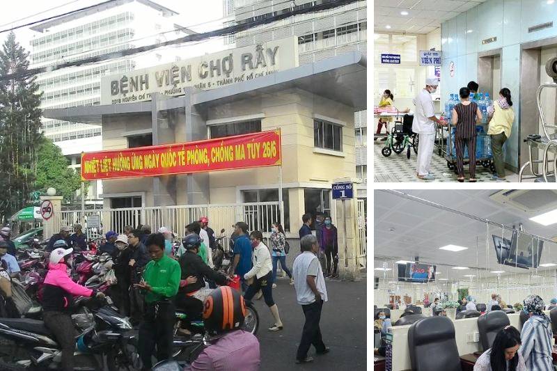 khám mắt tại bệnh viên chợ rẫy