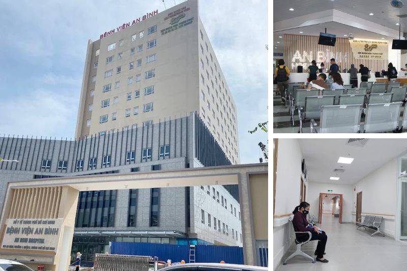 khám mắt tại bệnh viện an bình