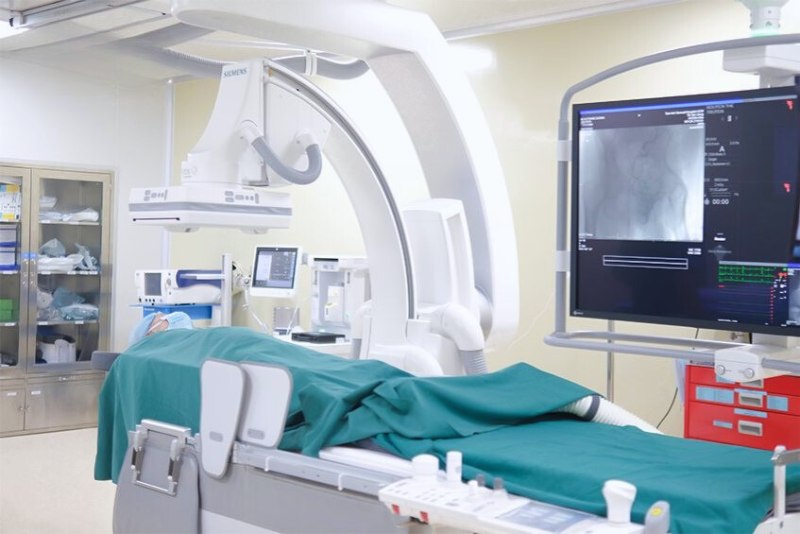 máy chụp mạch máu số hóa xóa nền dsa