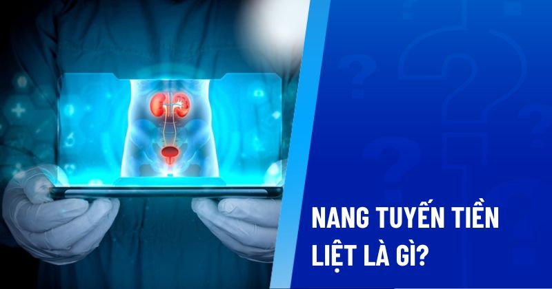 nang tuyến tiền liệt là gì