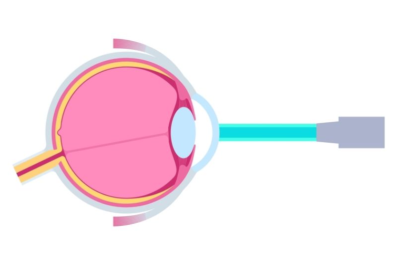 nguyên lý hoạt động