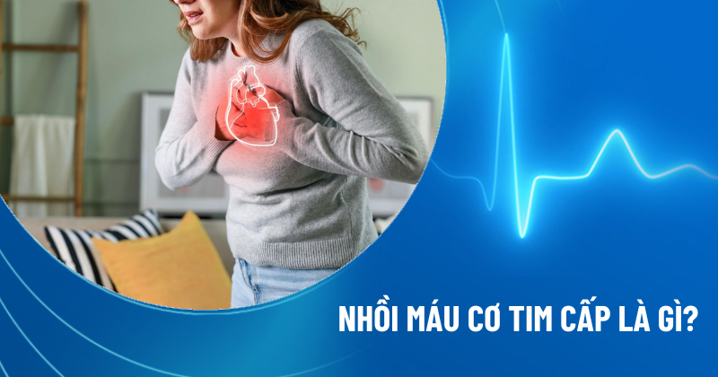 nhồi máu cơ tim cấp