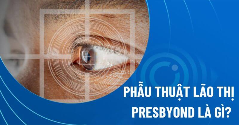 Công nghệ phẫu thuật lão thị Presbyond có an toàn không?