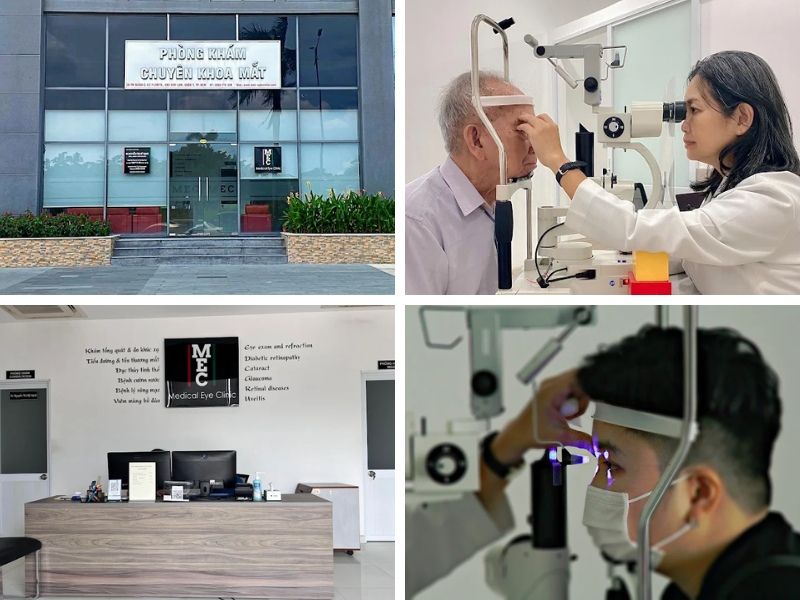 phòng khám chuyên khoa mắt mec