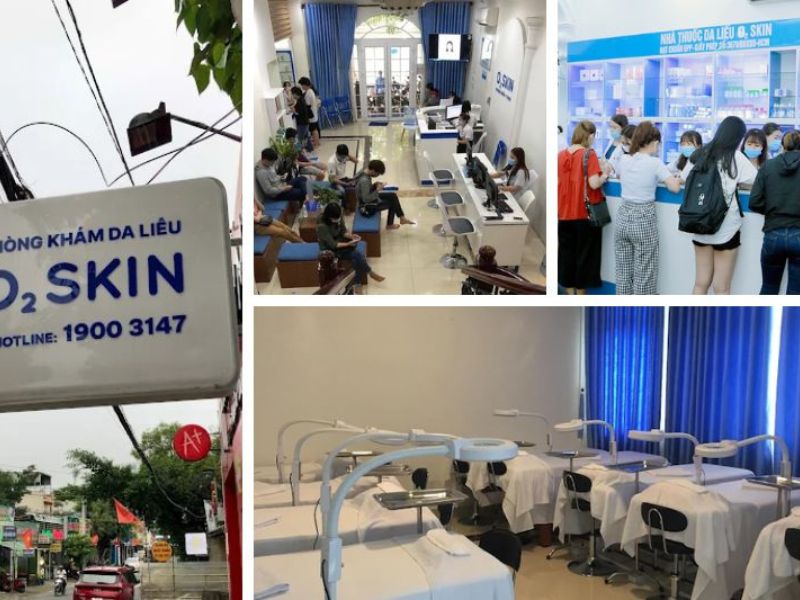 phòng khám da liễu o2 skin