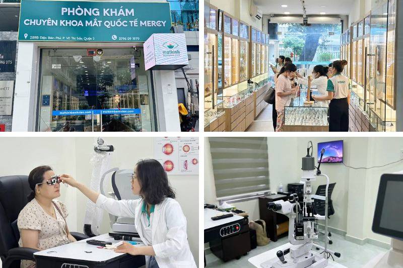phòng khám mắt quận 3 mercy