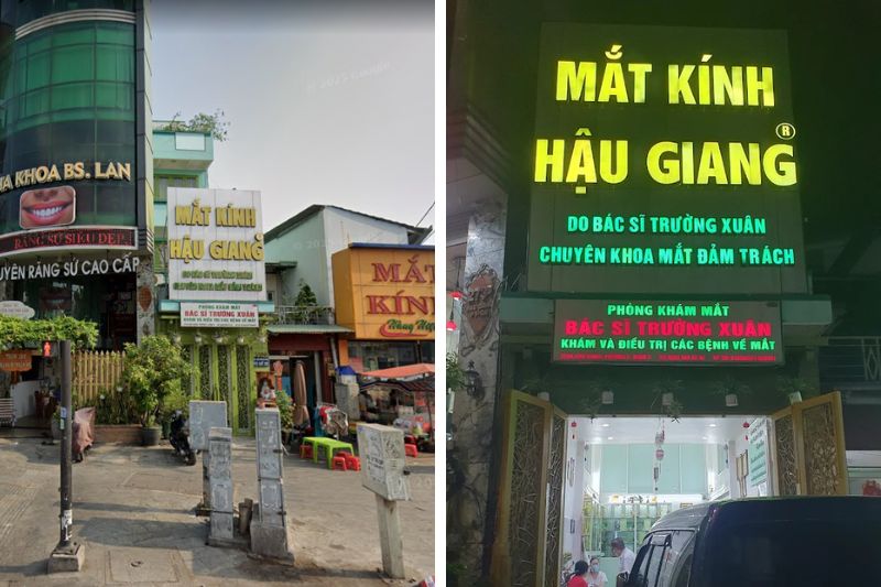 khám mắt tại phòng khám mắt bs trường xuân