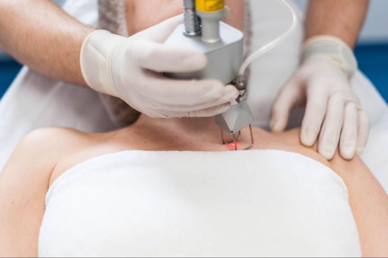 phương pháp laser