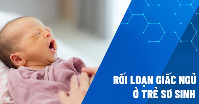 rối loạn giấc ngủ ở trẻ sơ sinh