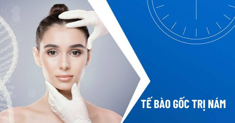 tế bào gốc trị nám