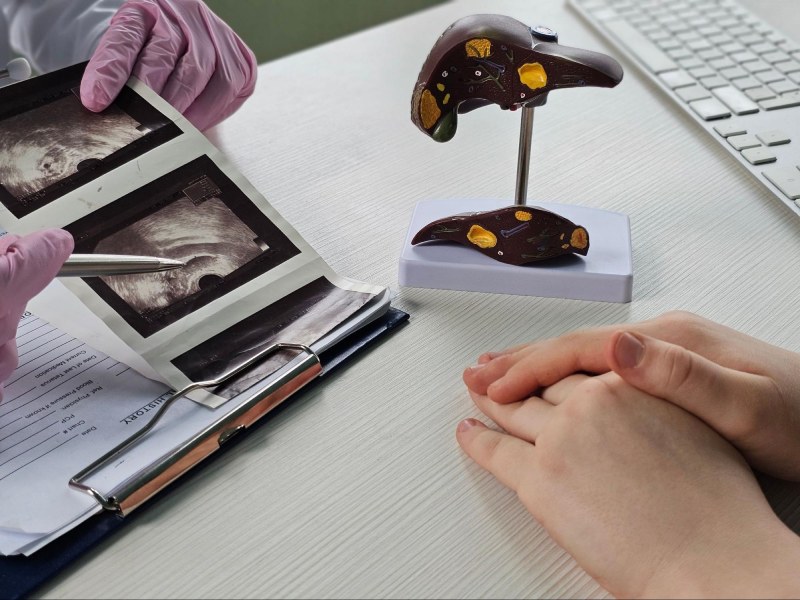 thực hiện chẩn đoán phù hợp để xác định viêm gan ứ sắt