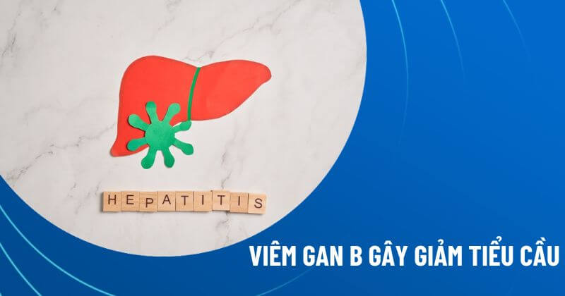 Viêm gan b gây giảm tiểu cầu