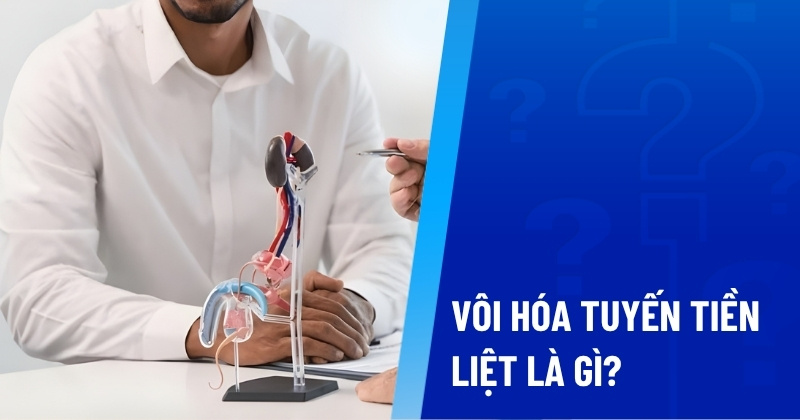 vôi hóa tuyến tiền liệt là gì