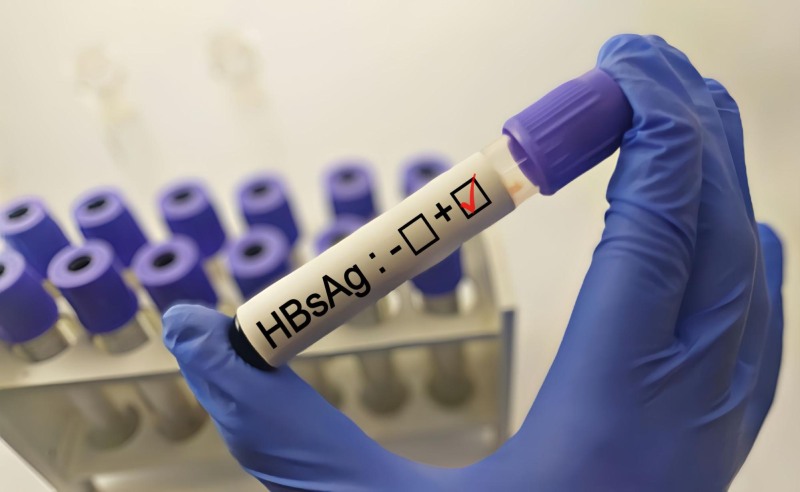 xét nghiệm hbsag chẩn đoán viêm gan b