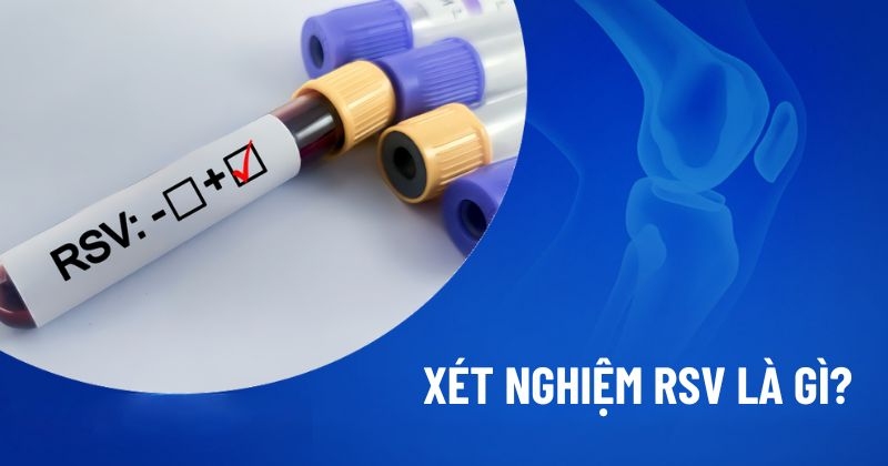 Xét nghiệm RSV là gì? Chỉ định thực hiện test khi nào?