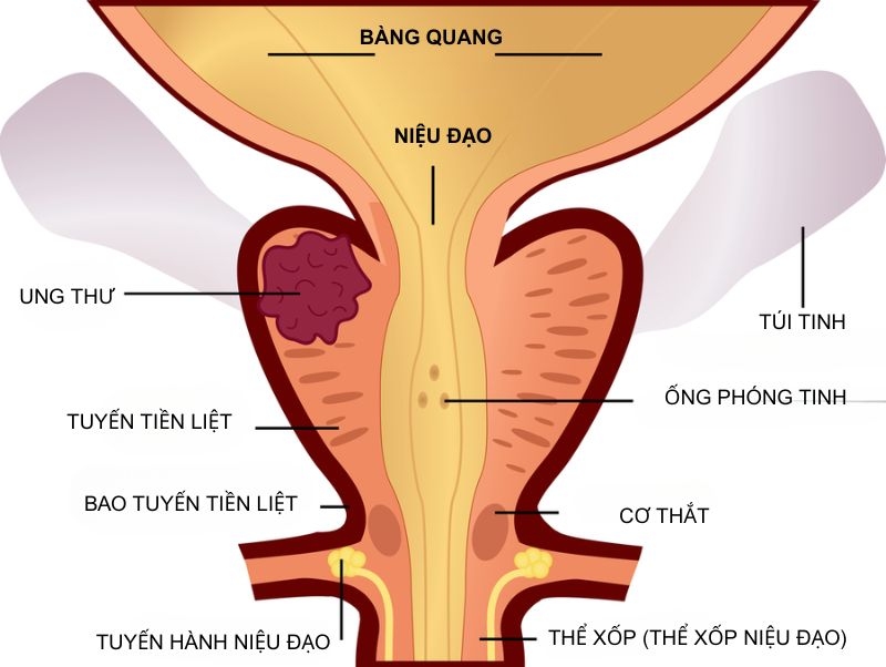 ảnh giải phẫu tiền liệt tuyến