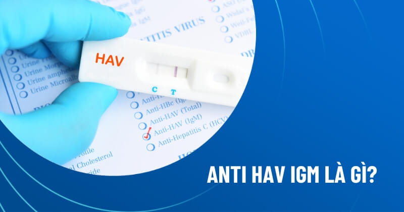 anti hav igm là gì